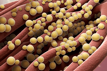 MDROs: MRSA
