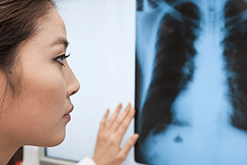 Prevention and Control of TB, Parts 1-2 (US)